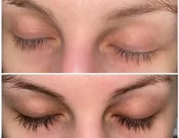 3-month lash treatment course